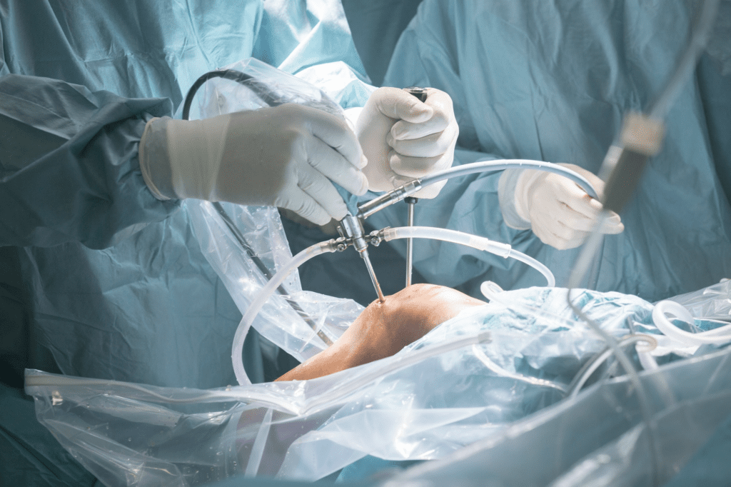 Preparing For Orthopaedic Surgery: The Patient’s Perspective