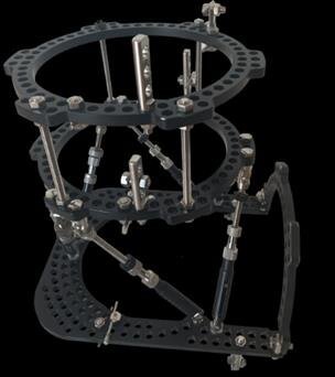 Integrant's FrameIt based on the Taylor Spatial Frame.